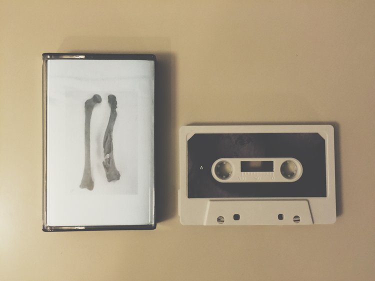 06. D.A.R.F.D.H.S. - Killing Is No Murder